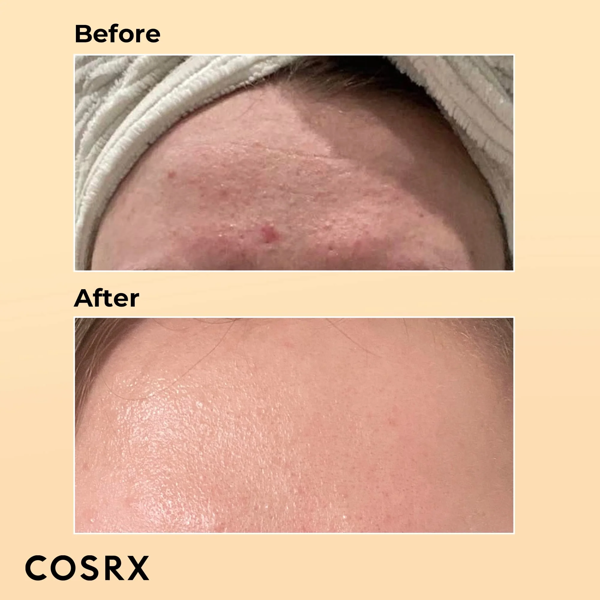 COSRX Advance Snail 96 Mucin Power Essence 3.38 fl.oz- 100 ml-6